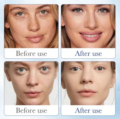 Serum Ácido H Antienvejecimiento