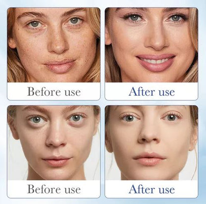 Serum Ácido H Antienvejecimiento